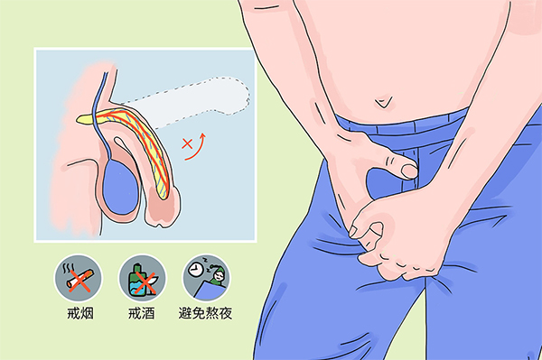 阳痿