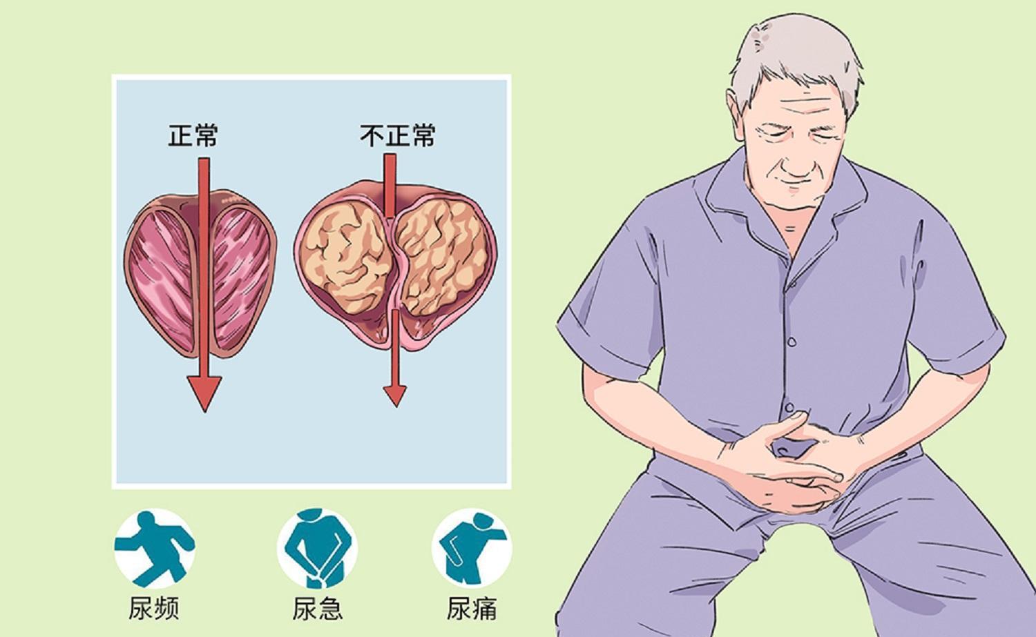 尿路感染