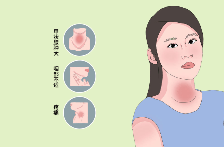 甲状腺结节严重吗？中医关键在于体质失衡的“病机”