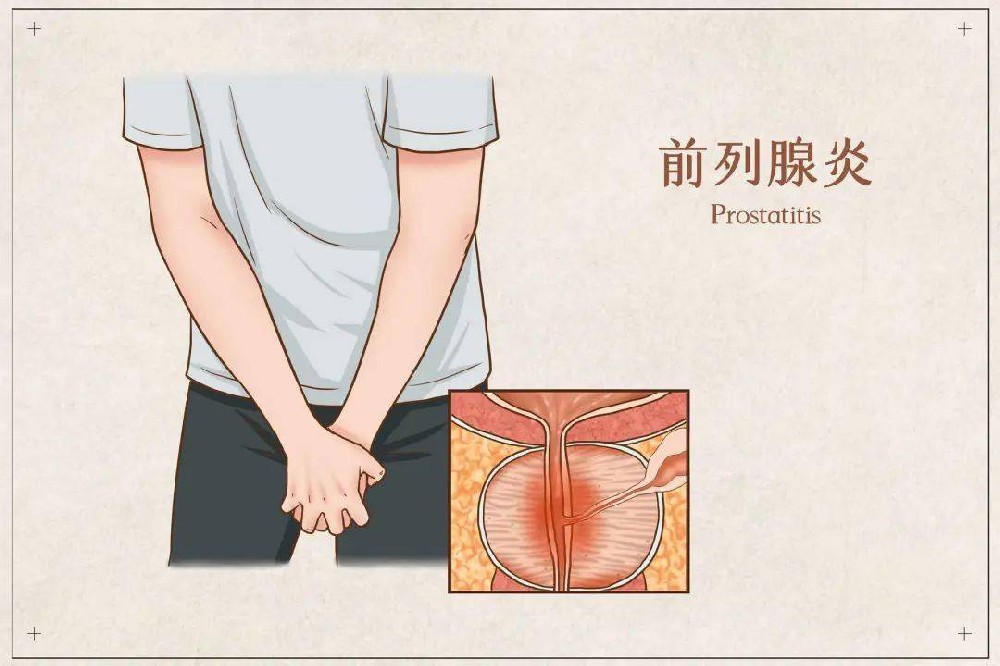 会阴部温热灼热、体温却正常？或是局部慢性炎症刺激