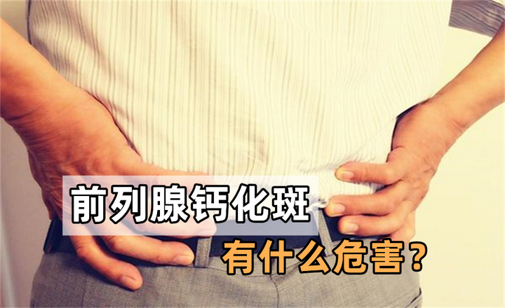 前列腺钙化灶需要处理吗？多为炎症愈合痕迹，无症状无需特殊干预