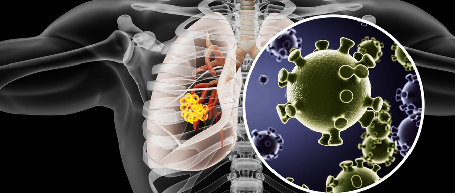 肺结节最怕这3件事！熊杰主任：做错一步，可能耽误最佳干预时机